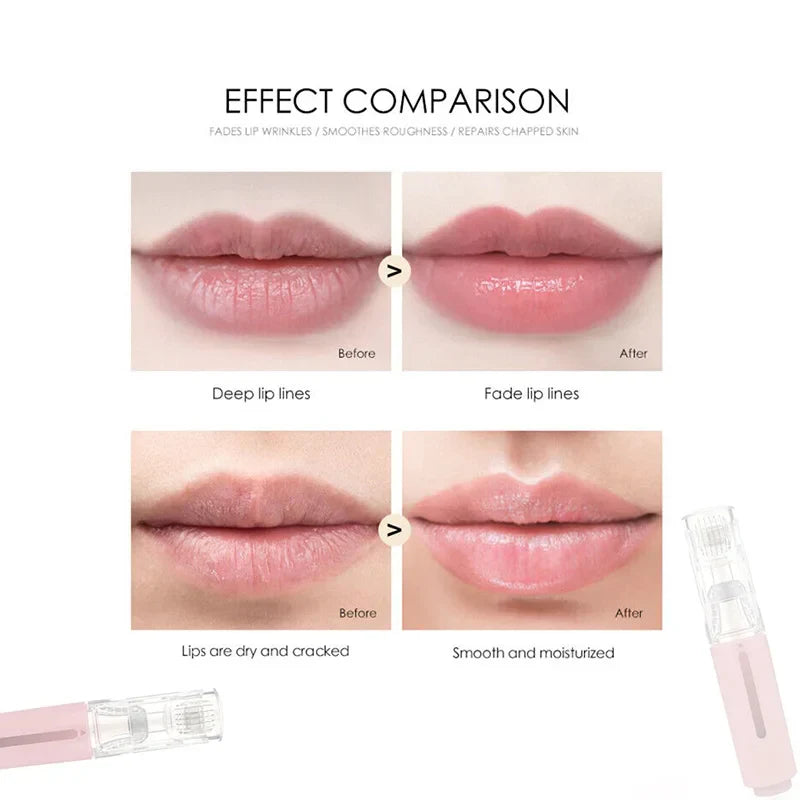 KissBliss™ Plump Lips Kit